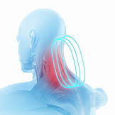 Myorelaxační efekt pulzní magnetoterapie Biomag
